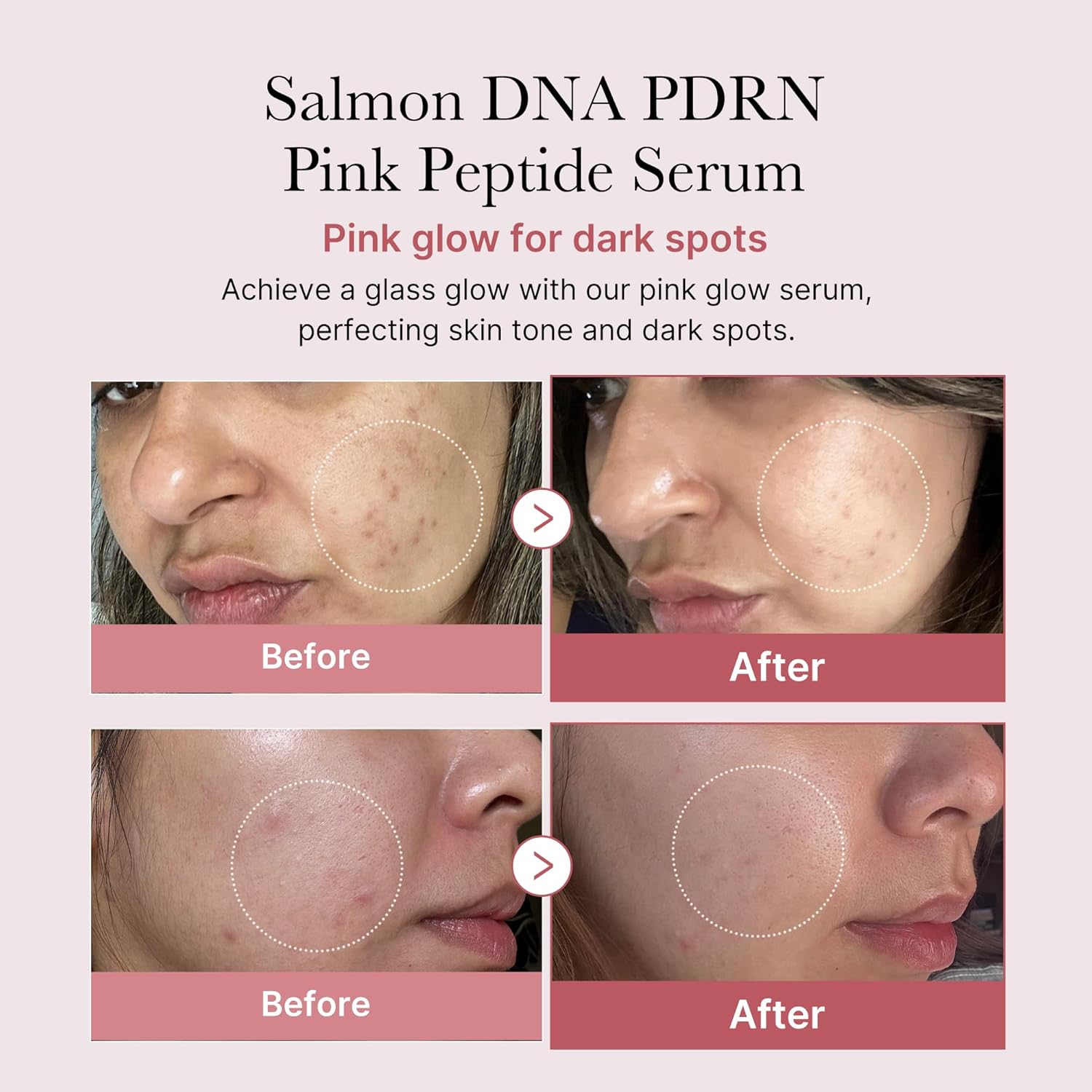 Medicube Salmon DNA PDRN Pink Peptide Serum – 1.01 fl.oz.