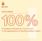 Bio-Oil Skincare Oil – 200ml