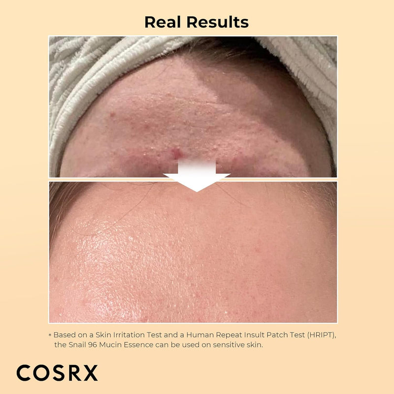 COSRX Snail Mucin 96% Power Repairing Essence 100ml, Hydrating Serum for Face with Snail Secretion Filtrate for Dull Skin & Fine Lines, Korean Skin Care