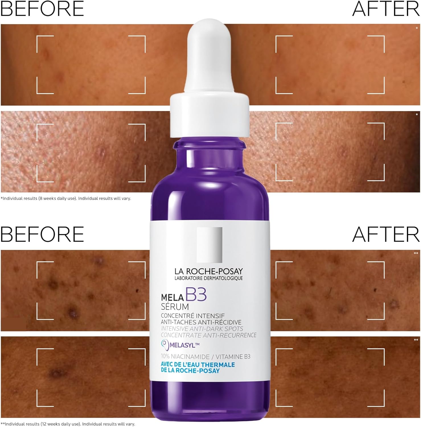 La Roche-Posay Mela B3 Serum bottle with 'Before' and 'After' skin texture comparison on a brown background.